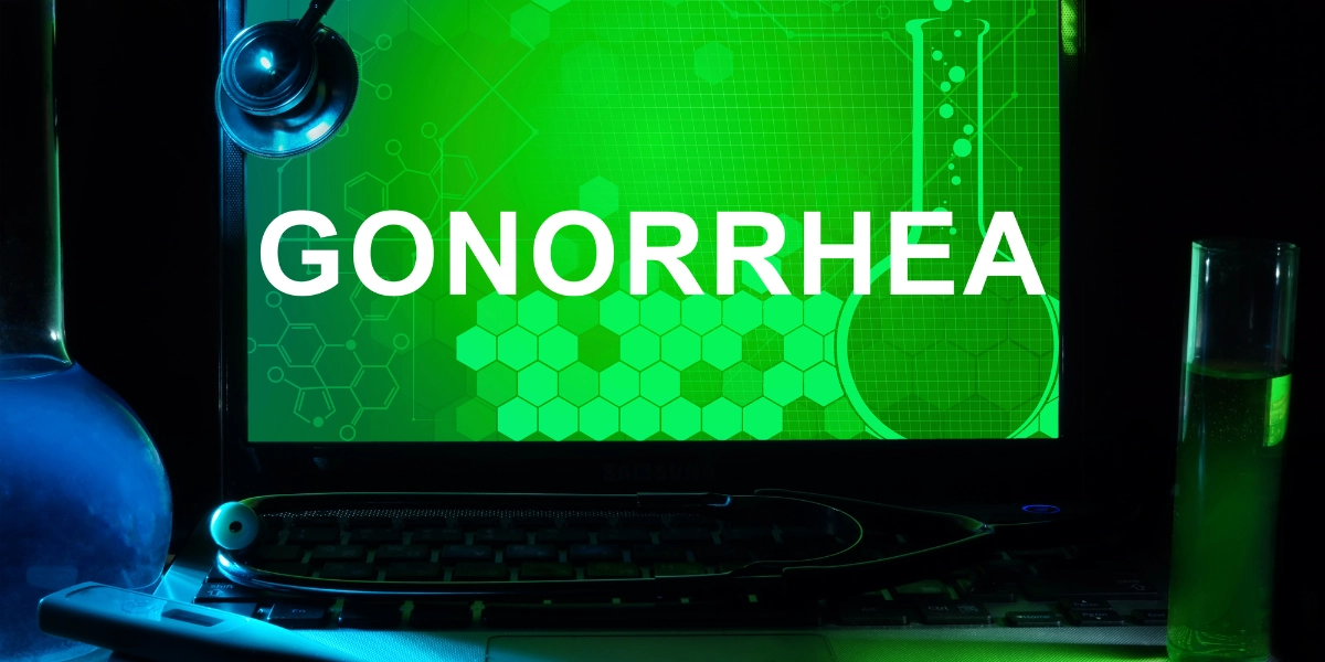 Gonorrhea Testing in Fort Myers, Florida